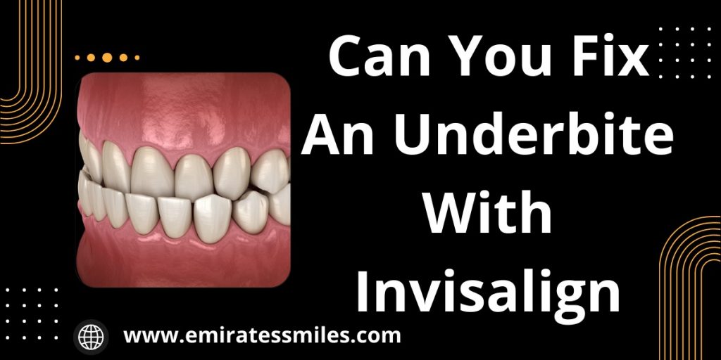 Can You Fix An Underbite With Invisalign